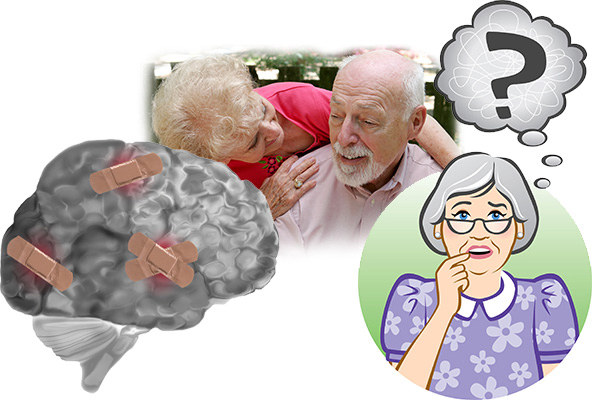Alzheimer's
