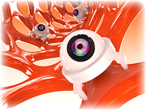 Nanoparticle