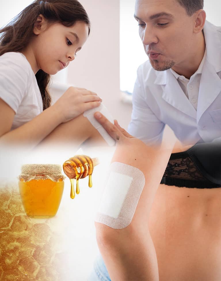 Manuka Honey Wound Care