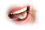 Dentist Mirror in Mouth
