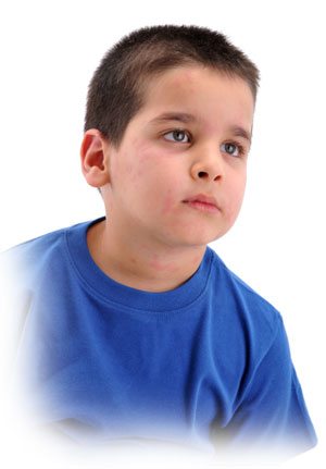 Boy with Measles Boy with Measles