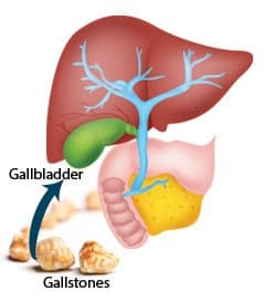 Gallbladder
