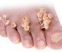 Fungal Skin Infections Part 1 