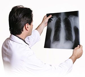 Heart Test - Chest X-Ray