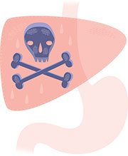 liver-cancer