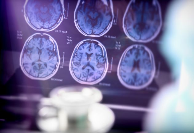 Support brain health
