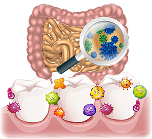 Bacteria