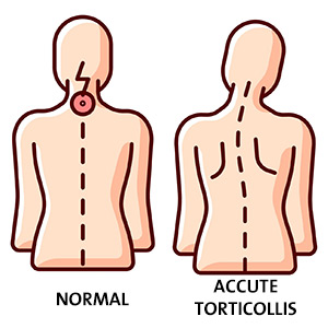 bad-posture-problems-rgb-color-icons-set-92503368 