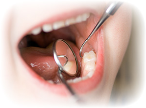 bchild-dental-check-up-0280183