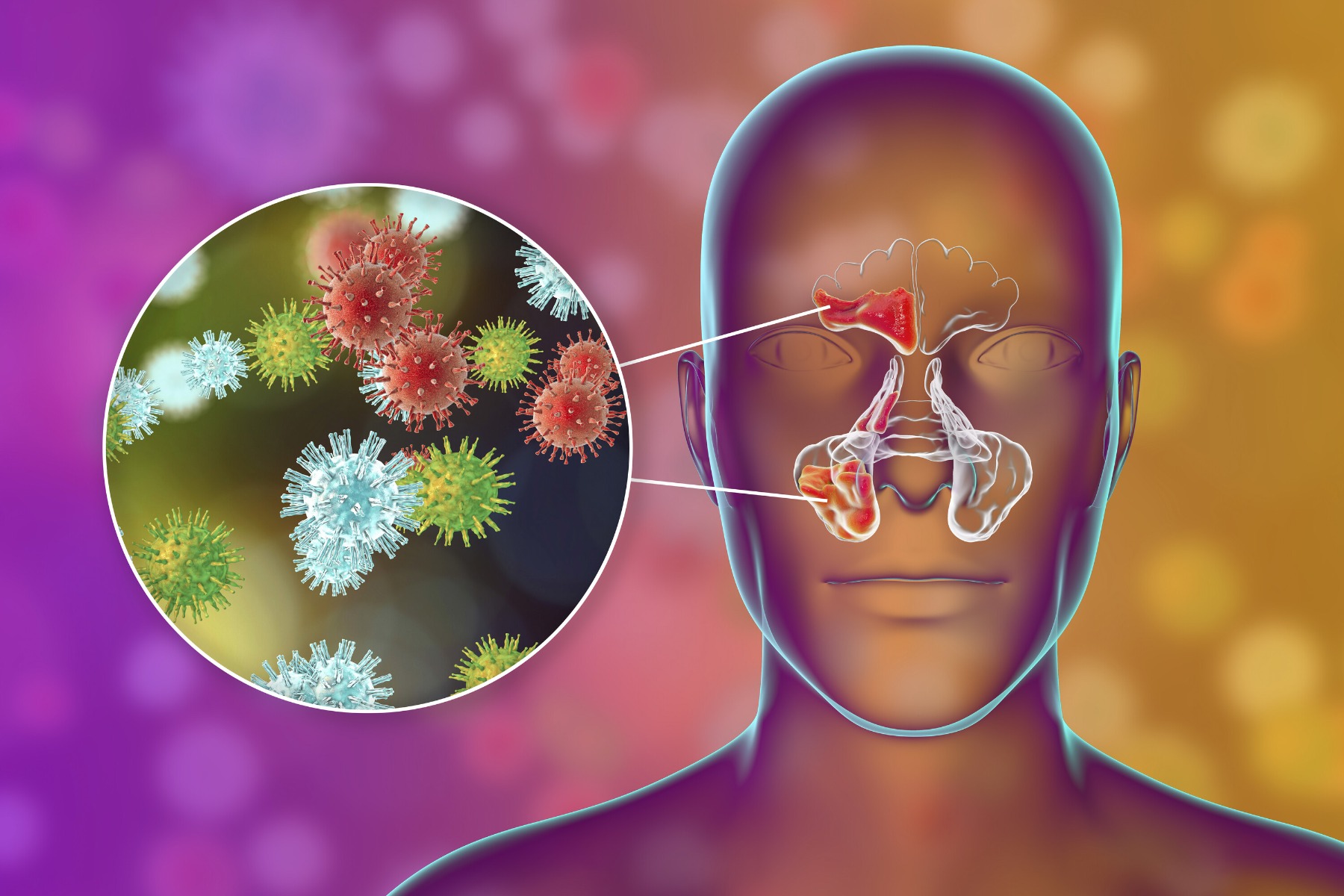 Common Cold
