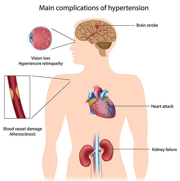 complications-of-hypertension-eps8-6495272