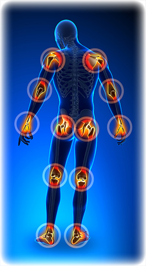 joints-pain-trauma-13365689 