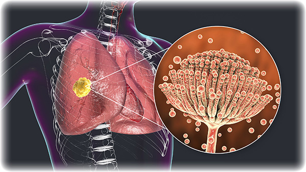 Lungs