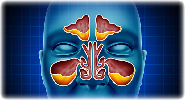 Sinus