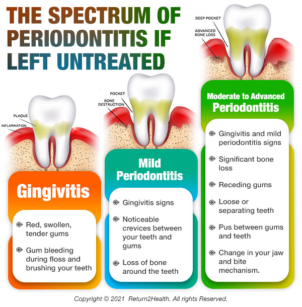 Teeth Infographgics