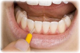 oral-hygiene