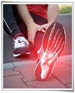 Plantar-fasciitis
