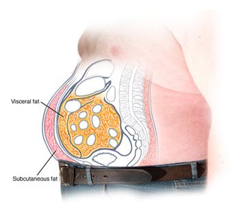 Viceral vs Subtaneous Fat