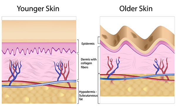 sun-exposure-skin