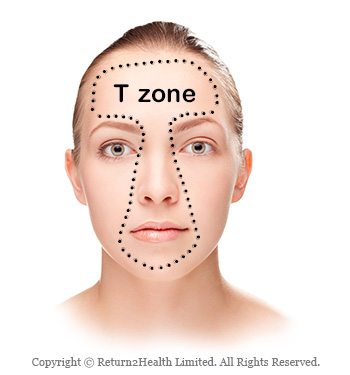 tzone