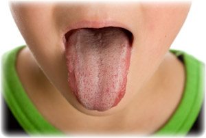 unhealthy-furred-or-coated-tongue